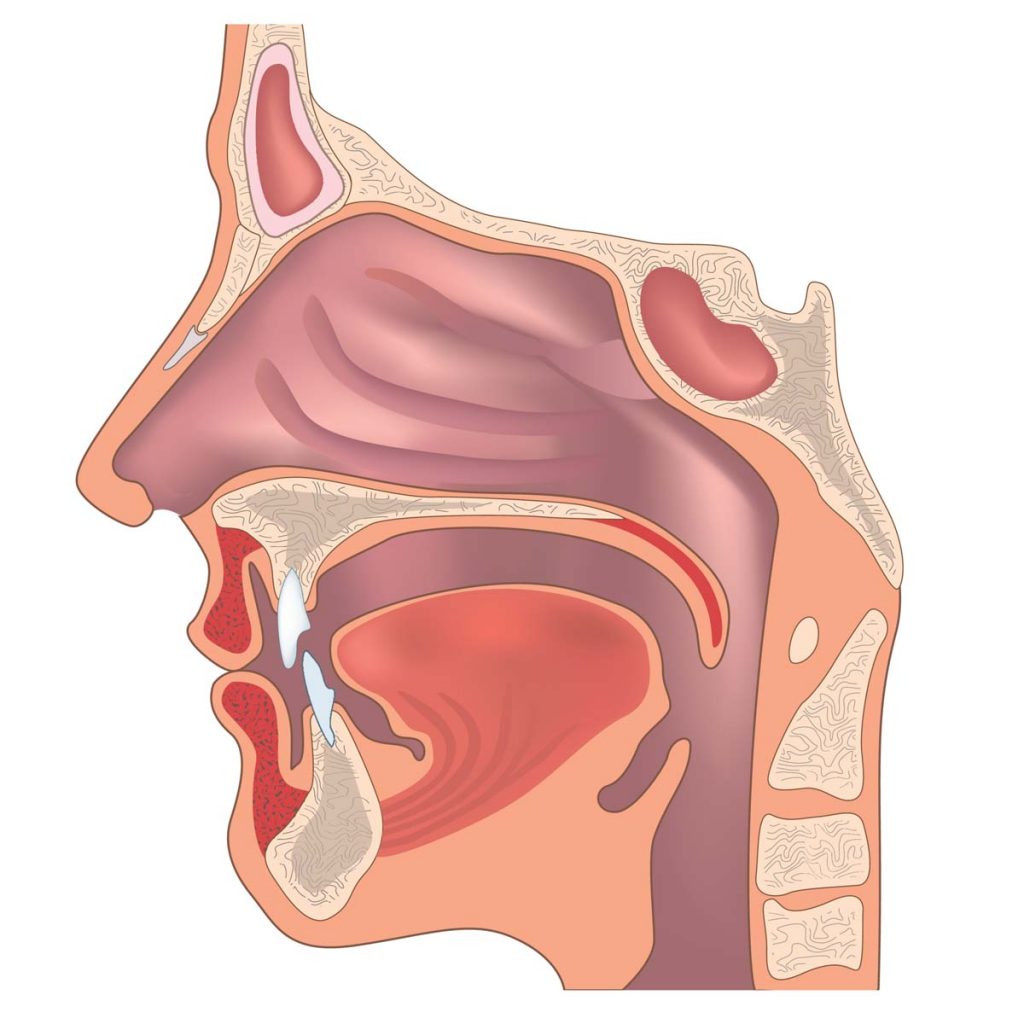 Diseases of Oral, Ear, Nose and Throat Related Systems